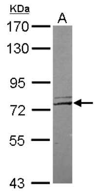 Western Blot: NGL-1/LRRC4C Antibody [NBP2-19516]
