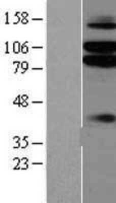 Western Blot: NGL-1/LRRC4C Overexpression Lysate [NBP2-06594]