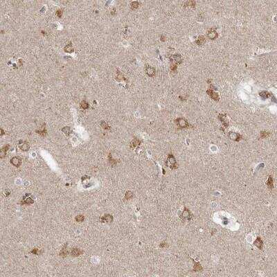 Immunohistochemistry: Neudesin Antibody [NBP2-13652]