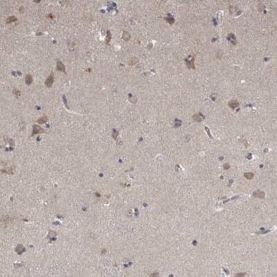 Immunohistochemistry-Paraffin: Neudesin Antibody [NBP1-84462]