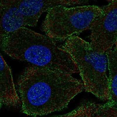 Immunocytochemistry/ Immunofluorescence: Neurabin 1 Antibody [NBP2-69010]