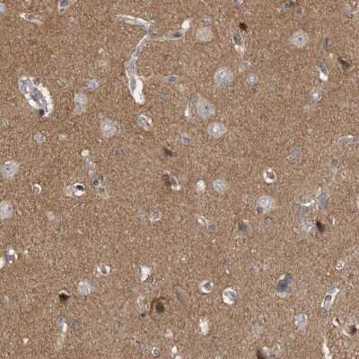 Immunohistochemistry-Paraffin: Neurabin 1 Antibody [NBP1-89857]