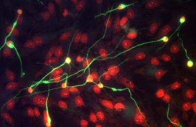 Immunocytochemistry/ Immunofluorescence: Neural Stem Cell Marker Antibody Pack [NBP1-42826]