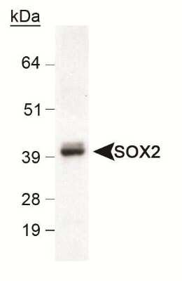 Western Blot: Neural Stem Cell Marker Antibody Pack [NBP1-42826]