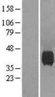 Western Blot: NEU-1/Sialidase-1 Overexpression Lysate [NBL1-13594]