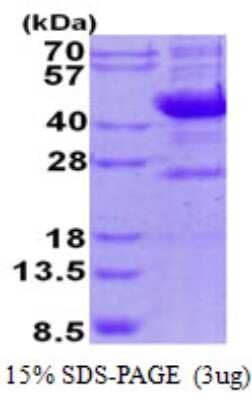 SDS-PAGE: Recombinant Human NEU-1/Sialidase-1 His Protein [NBP2-23471]