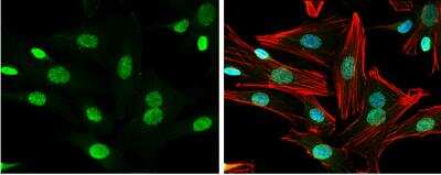 Immunocytochemistry/ Immunofluorescence: Neuregulin-1/NRG1 Antibody [NBP2-19587]