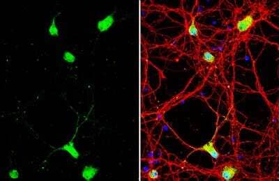 Immunocytochemistry/ Immunofluorescence: Neuregulin-1/NRG1 Antibody [NBP2-19588]