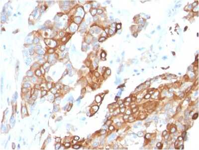 Immunohistochemistry-Paraffin: Neuregulin-1/NRG1 Antibody (NRG1/2710) [NBP3-07721]