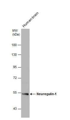 Western Blot: Neuregulin-1/NRG1 Antibody [NBP2-19587]