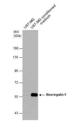 Western Blot: Neuregulin-1/NRG1 Antibody [NBP2-19587]