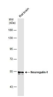 Western Blot: Neuregulin-1/NRG1 Antibody [NBP2-19587]