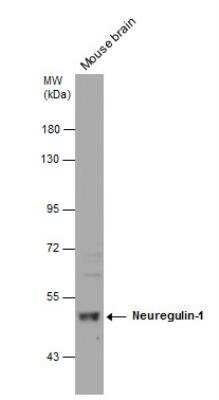 Western Blot: Neuregulin-1/NRG1 Antibody [NBP2-19588]