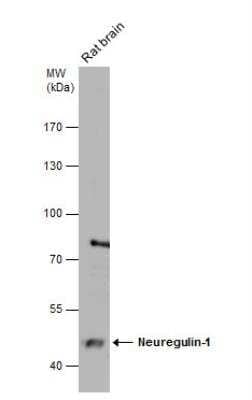 Western Blot: Neuregulin-1/NRG1 Antibody [NBP2-19588]