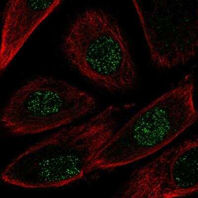 Immunocytochemistry/ Immunofluorescence: Neuregulin-2 Antibody [NBP1-87971]