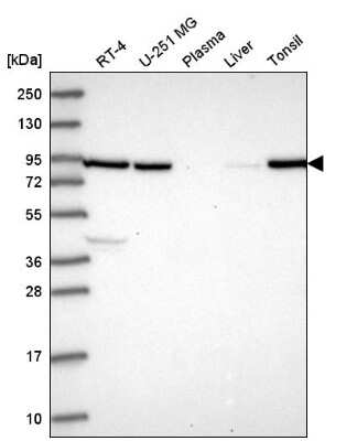 Western Blot: Neuregulin-2 Antibody [NBP2-57043]