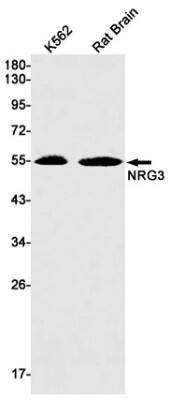 Western Blot: Neuregulin-3/NRG3 Antibody (S02-9E5) [NBP3-19721]