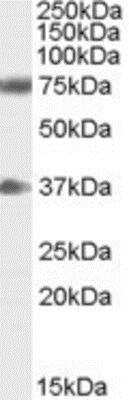 Western Blot: Neuregulin-3/NRG3 Antibody [NB100-61670]