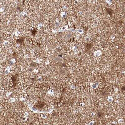 Immunohistochemistry-Paraffin: Neurexin 3/NRXN3 Antibody [NBP1-88424]