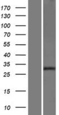 Western Blot: Neurexophilin 2 Overexpression Lysate [NBP2-10377]