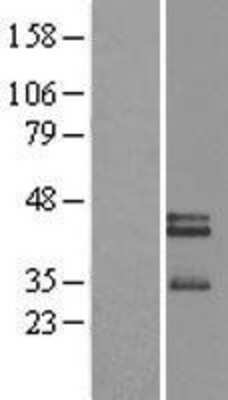 Western Blot: Neurexophilin-3 Overexpression Lysate [NBL1-13894]