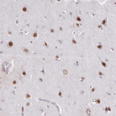 Immunohistochemistry-Paraffin: Neuro D4 Antibody [NBP2-13932]