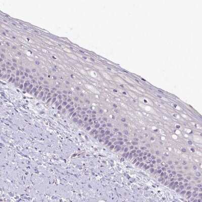 Immunohistochemistry-Paraffin: Neuro D4 Antibody [NBP2-13932]