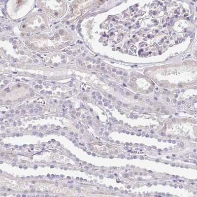 Immunohistochemistry-Paraffin: Neuro D4 Antibody [NBP2-13932]