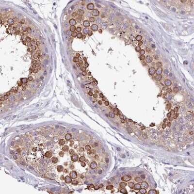 Immunohistochemistry-Paraffin: Neuro D4 Antibody [NBP2-13932]