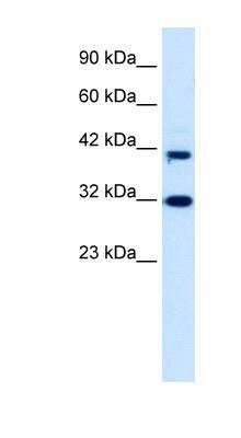 Western Blot: Neuro D4 Antibody [NBP1-80040]