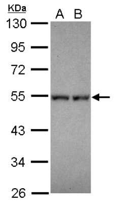 Western Blot: Neuro D4 Antibody [NBP2-19518]