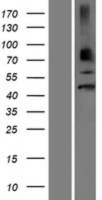 Western Blot: Neuro D4 Overexpression Lysate [NBP2-11099]