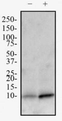 Western Blot: Neuro2a Chloroquine Treated / Untreated Cell Lysate [NBP2-49688]