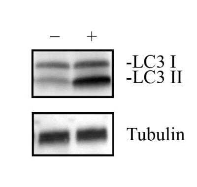 Western Blot: Neuro2a Chloroquine Treated / Untreated Cell Lysate [NBP2-49688]