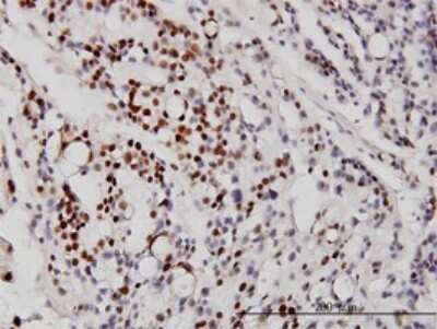 Immunohistochemistry-Paraffin: NeuroD1 Antibody (3H8) [H00004760-M01]