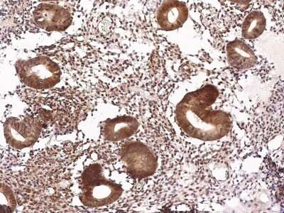Immunohistochemistry-Paraffin: NeuroD1 Antibody [NBP2-98697]