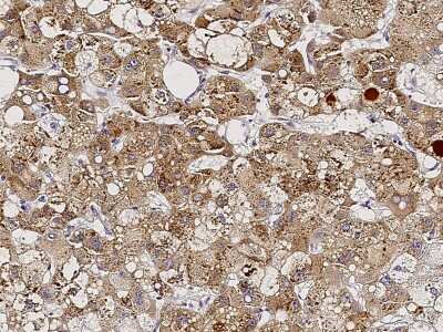 Immunohistochemistry-Paraffin: NeuroD1 Antibody [NBP2-98697]