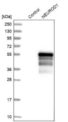 Western Blot: NeuroD1 Antibody [NBP1-88661]