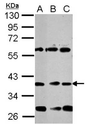 Western Blot: NeuroD1 Antibody [NBP2-19519]