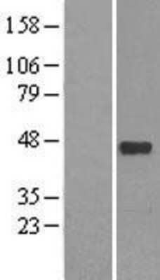 Western Blot: NeuroD1 Overexpression Lysate [NBL1-13598]