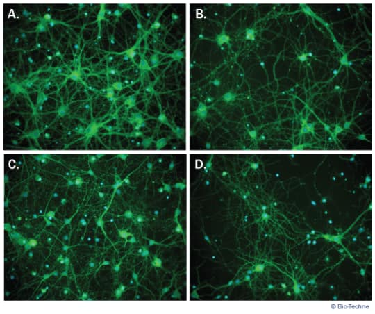 Enhanced Neurite Development and Branching using the NeuroXVivo™ Rat Cortical Neuron Culture Kit Compared to Competitor. 