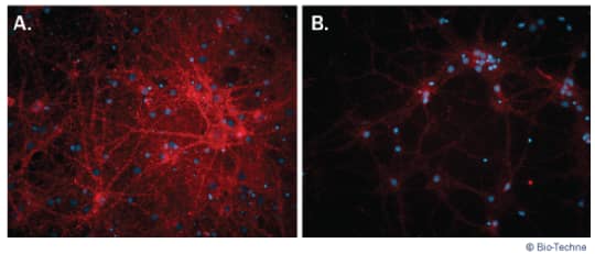 More Robust Synaptic Puncta Development for Primary Rat Cortical Neurons Cultured using NeuroXVivo™ Rat Cortical Neuron Culture Kit.