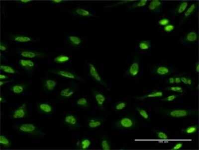 Immunocytochemistry/ Immunofluorescence: Neurobeachin Antibody (3F11) [H00026960-M01]