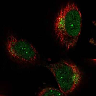 Immunocytochemistry/ Immunofluorescence: Neurobeachin Antibody [NBP1-90003]