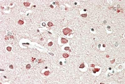 Immunohistochemistry-Paraffin: Neurobeachin Antibody [NB100-55385]