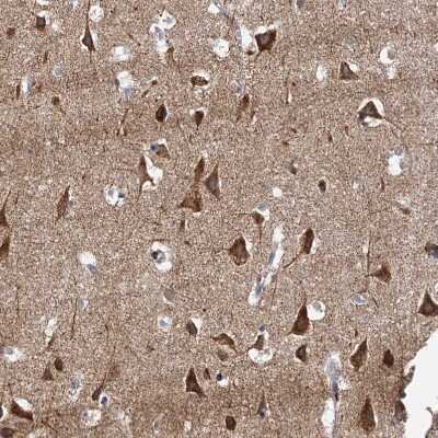 Immunohistochemistry-Paraffin: Neurobeachin Antibody [NBP1-90003]