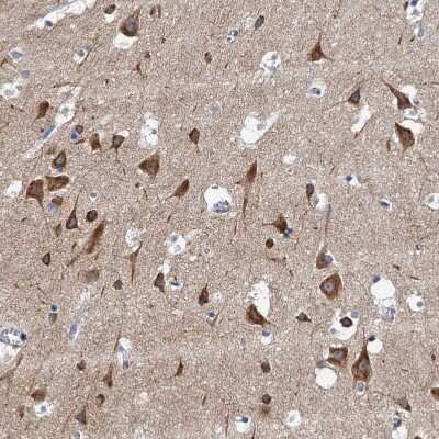 Immunohistochemistry-Paraffin: Neurobeachin Antibody [NBP1-90004]