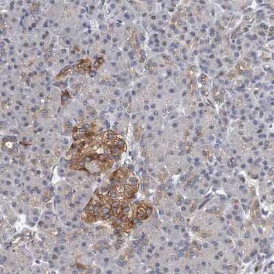 Immunohistochemistry-Paraffin: Neurobeachin Antibody [NBP1-90004]