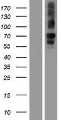 Western Blot: Neurobeachin Overexpression Lysate [NBP2-07133]