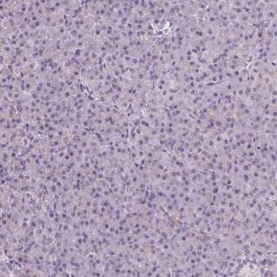 Immunohistochemistry-Paraffin: Neurocan Antibody [NBP1-84368]